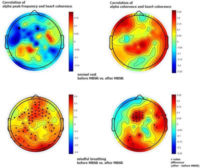 Increased neurocardiological interplay after mindfulness meditation: a brain oscillation-based approach
